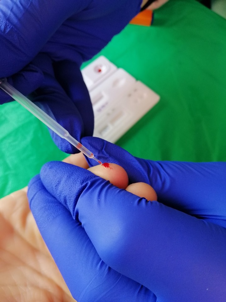 Черкащани зможуть пройти безкоштовне тестування на ВІЛ/СНІД