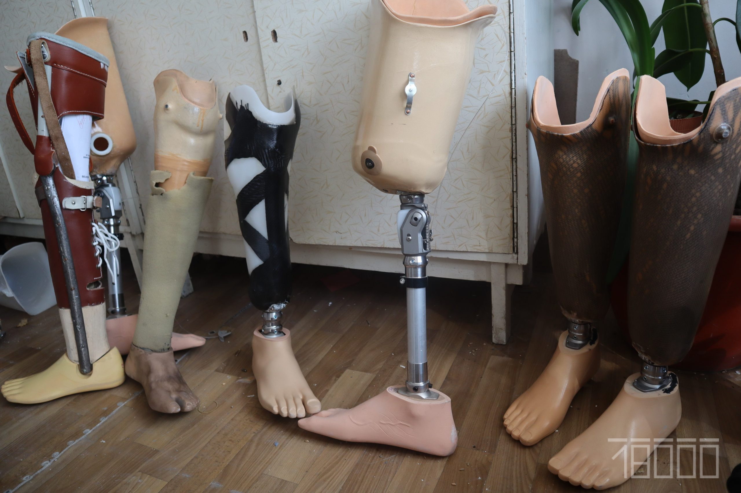 Протезування в Черкасах