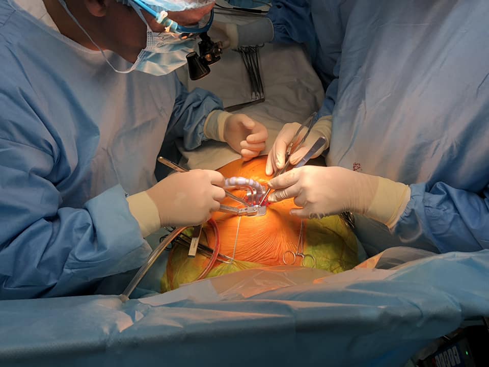 операція у Черкаському кардіоцентрі