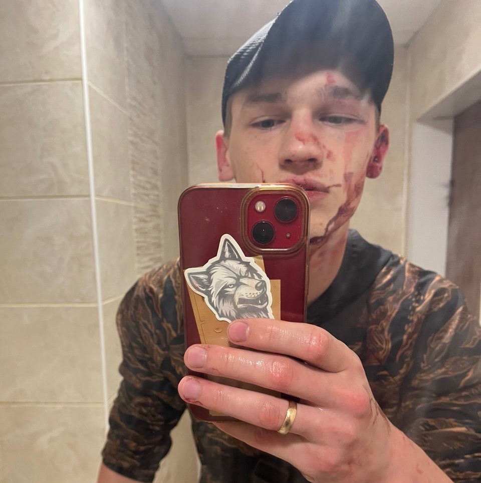 військовий після побиття