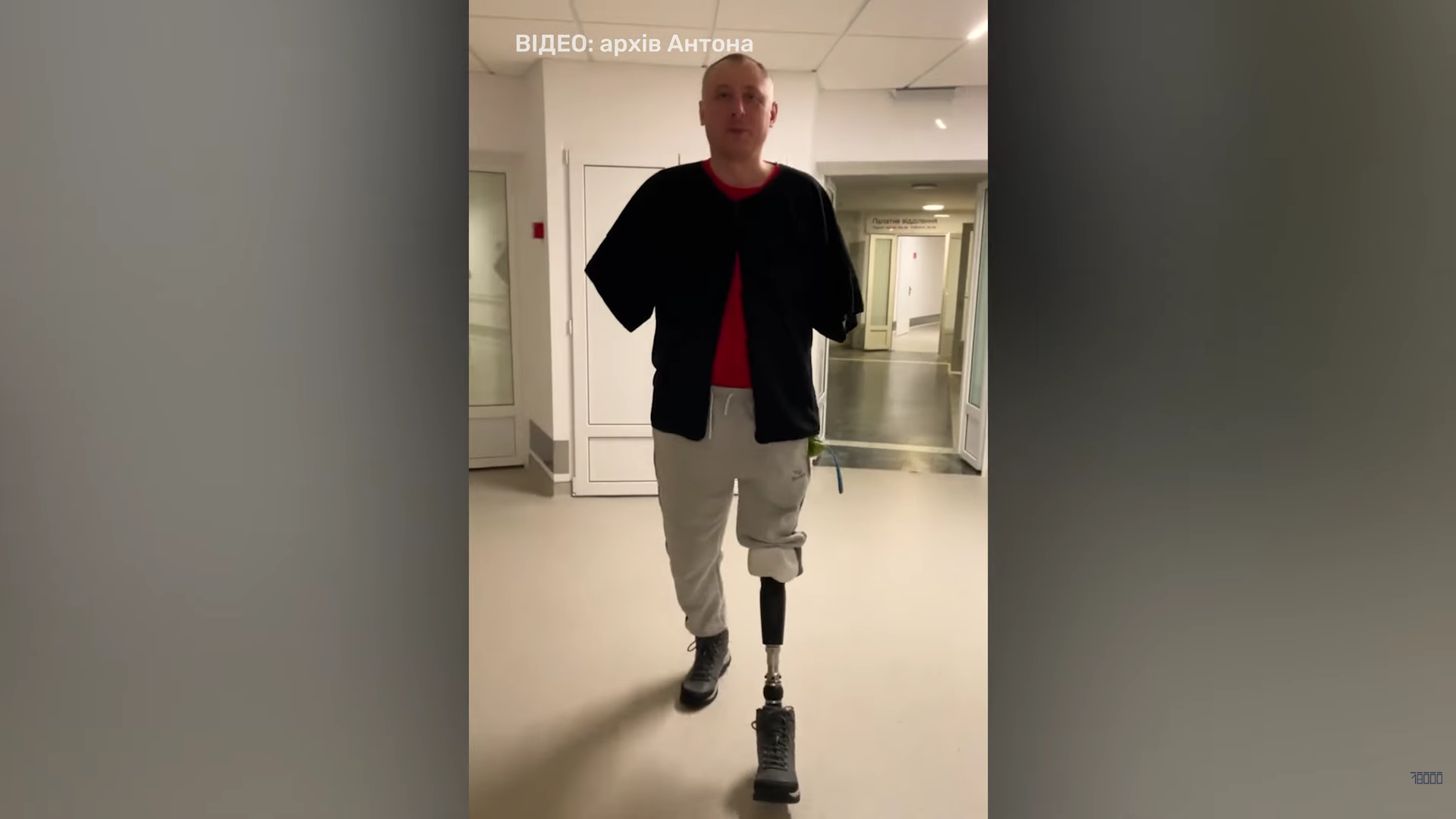 Антон Іванців у протезі