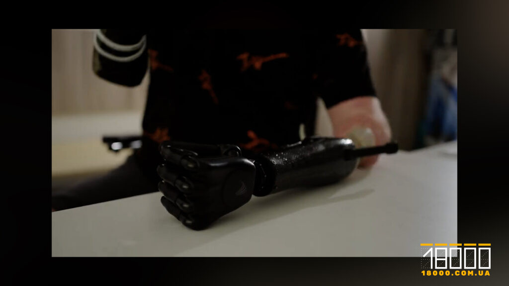 біонічний протез