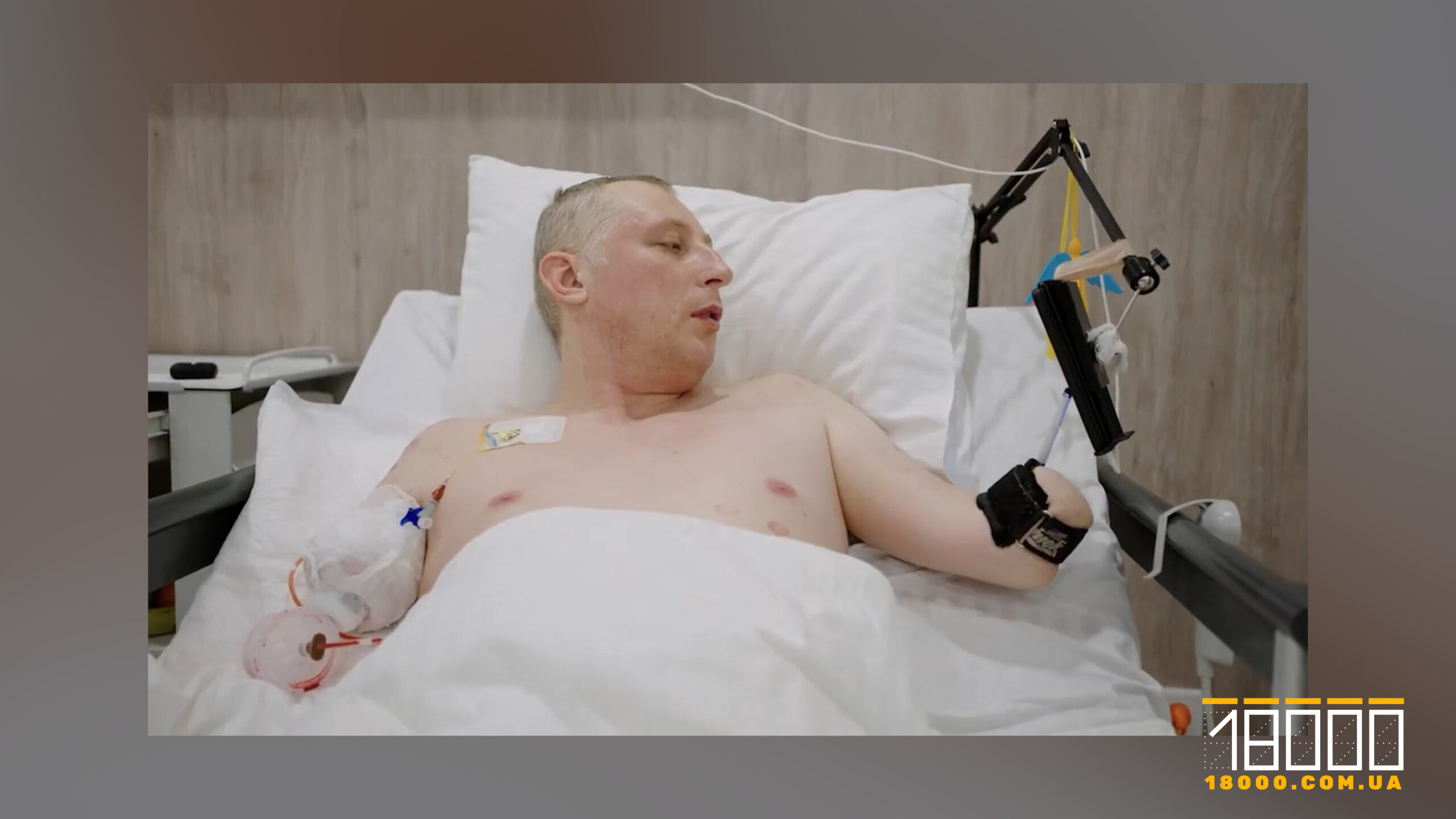 ветеран Антон Іванців після ампутацій у лікарні