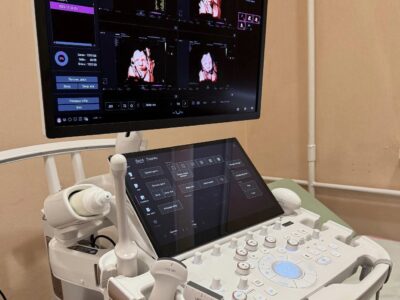 УЗД-апарат
