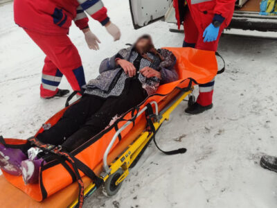 жінка з обмороженням