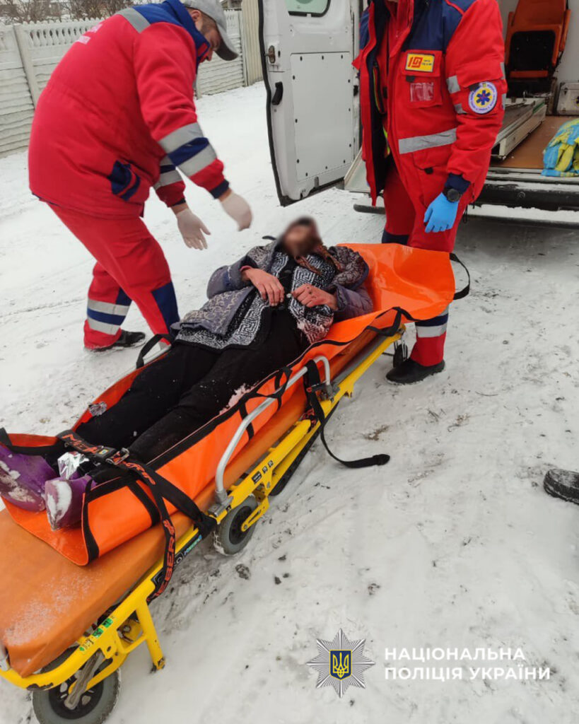 жінка з обмороженням