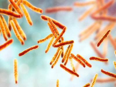 Туберкульоз