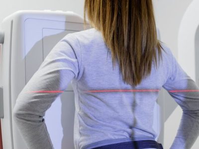 жінка робить флюорографію