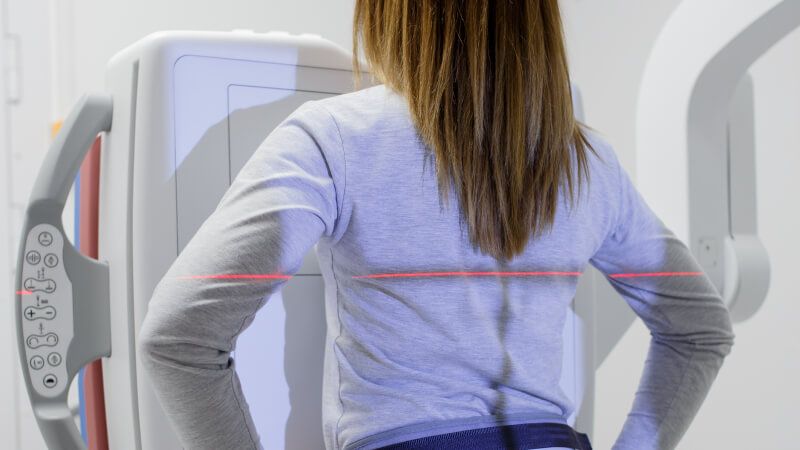 жінка робить флюорографію