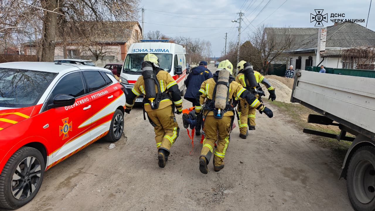 У Золотоноші під час пожежі у власному будинку травмувався чоловік (ФОТО)