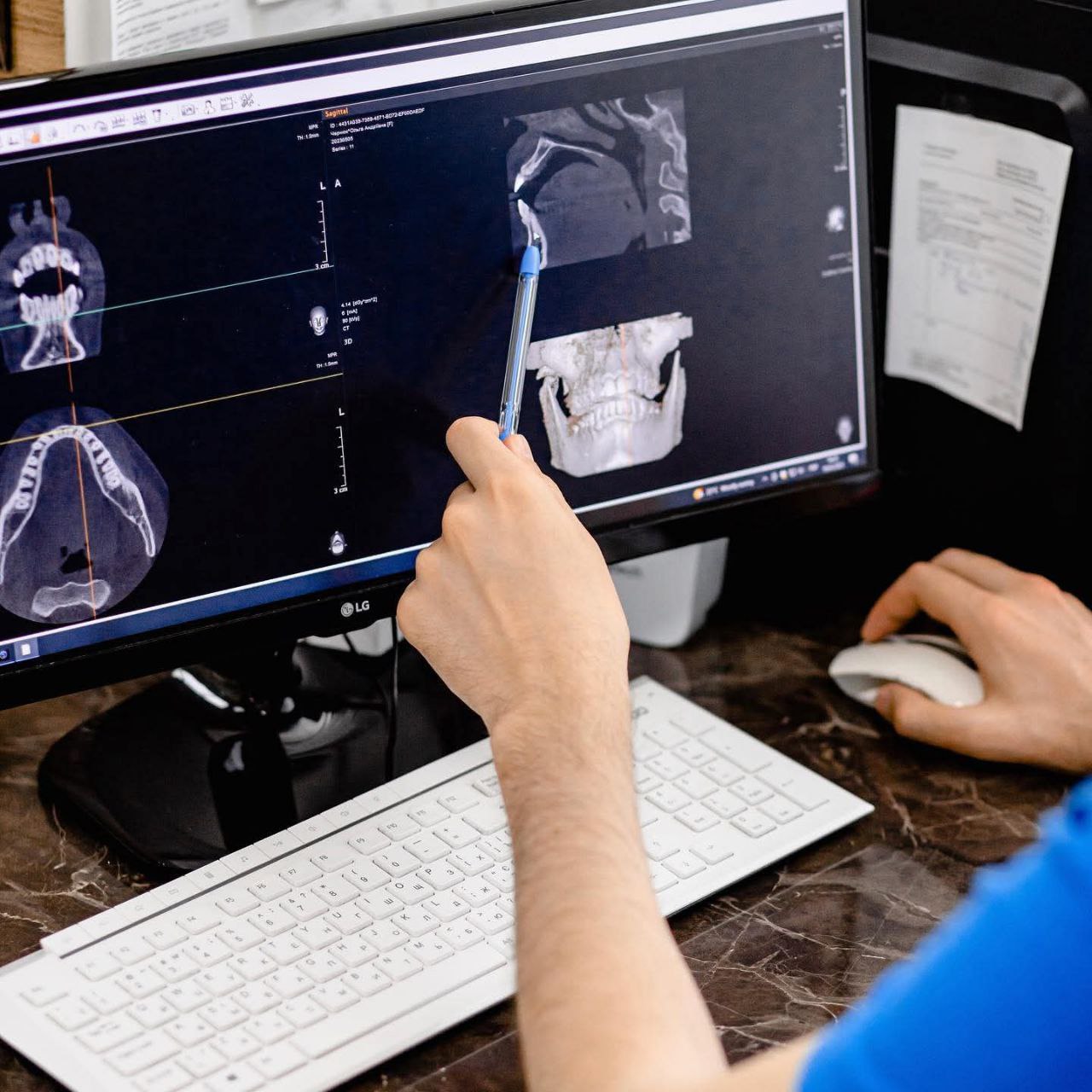 Знімок ротової порожнини