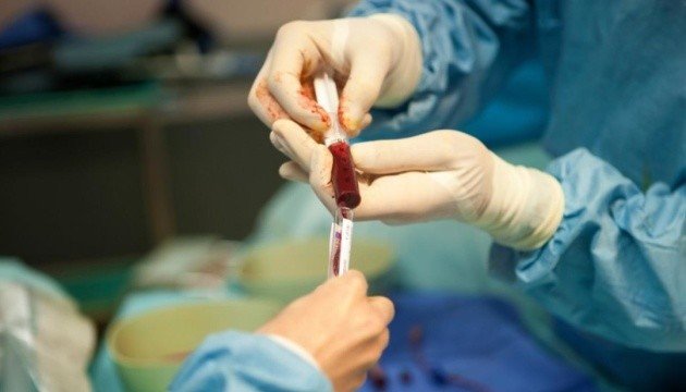 У черкаському онкоцентрі провели ювілейну трансплантацію